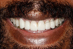 man's smile after color correcting