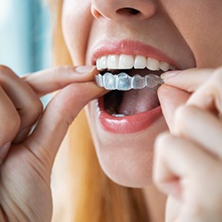 Woman putting in aligner for Invisalign in Owings Mills, MD 