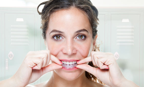 woman putting in clear braces