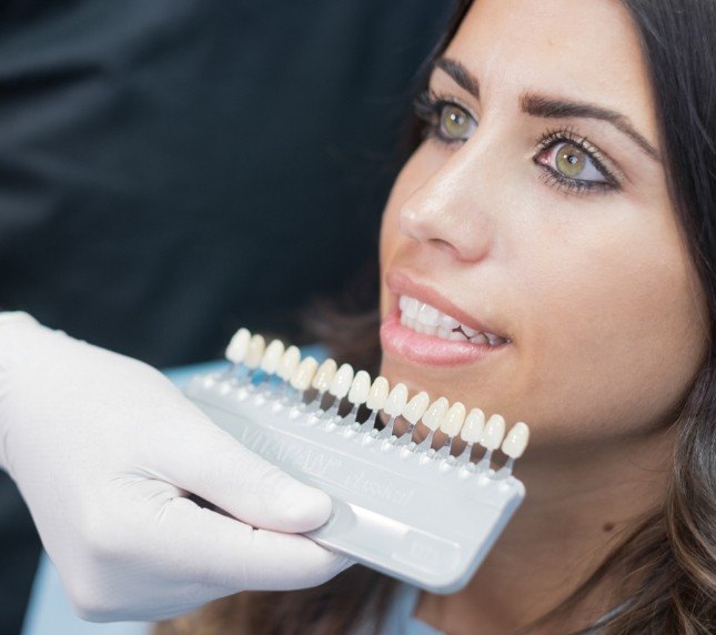 Man with veneers in Owings Mills