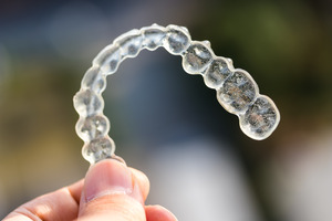 Close-up of hand holding an Invisalign aligner